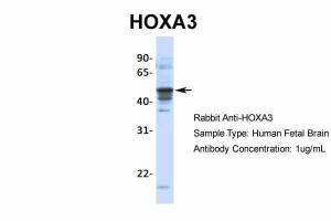 Anti-HOXA3 Rabbit Polyclonal Antibody