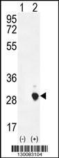 Anti-CSH1 Rabbit Polyclonal Antibody