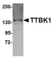 Western blot analysis of ZBED3 in human lung tissue lysate with ZBED3 antibody at 1 &#956;g/mL in (A) the absence and (B) the presence of blocking peptide.