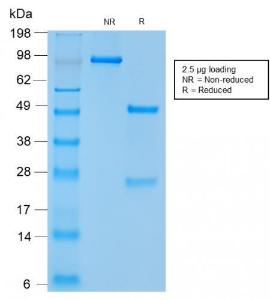 SDS-PAGE analysis of Anti-NCAM1 Antibody [NCAM1/2217R] under non-reduced and reduced conditions; showing intact IgG and intact heavy and light chains, respectively. SDS-PAGE analysis confirms the integrity and purity of the antibody