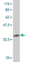 Anti-MAPK13 Mouse Monoclonal Antibody [clone: 1E6]