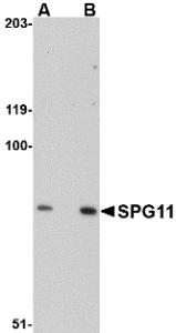 Western blot analysis of MATN4 in rat brain tissue lysate with MATN4 antibody at 1 &#956;g/mL in (A) the absence and (B) the presence of blocking peptide.