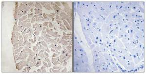 Antibody anti-collagen VI alpha 1 100 µg