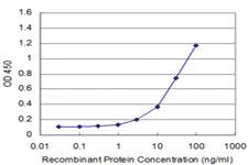 Anti-CDC42BPB Mouse Monoclonal Antibody [clone: 6G3]