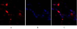 Immunofluorescence analysis of human lung tissue using Anti-p38 MAPK Antibody (red) at 1:200 (4°C overnight). Cy3 labelled secondary antibody was used at 1:300 (RT 50min). Panel A: Target. Panel B: DAPI. Panel C: Merge