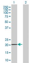 Anti-MS4A4A Mouse Polyclonal Antibody