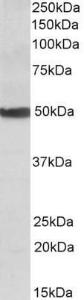 Anti-CYP24A1 Antibody (A82976) (0.1µg/ml) staining of Human Liver lysate (35µg protein in RIPA buffer). Primary incubation was 1 hour. Detected by chemiluminescence.