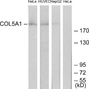 Anti-Collagen V Rabbit Polyclonal Antibody