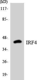 Antibody anti-IRF4 A99402-100 100 µg