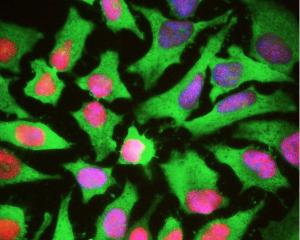 HeLa cells stained with BSENC-1700-100 (green) and a monoclonal antibody to High mobility Group B protein 1 (BSENM-1702-100, red). The HSP27 antibody reveals strong cytoplasmic staining and penetrates into the actin rich ruffled margins. The blue stain reveals DNA in the nuclei of these cells.