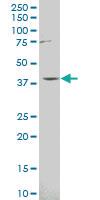 Anti-PRSS8 Mouse Polyclonal Antibody