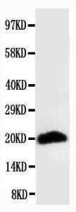 Anti-Myosin (Skeletal, Fast) Mouse Monoclonal Antibody [clone: MY-38]