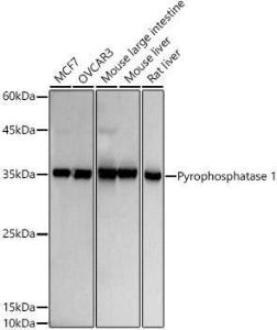 Western blot analysis of extracts of various cell lines, using Anti-Pyrophosphatase 1 Antibody [ARC2928] (A307764) at 1:500 dilution