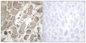 Anti-Collagen V Rabbit Polyclonal Antibody