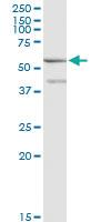 Anti-ME1 Mouse Monoclonal Antibody [clone: 2A2]