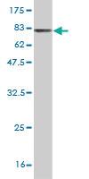 Anti-DLD Mouse Monoclonal Antibody [clone: 3C1]