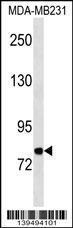 Anti-MFI2 Rabbit Polyclonal Antibody