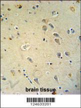 Anti-GRIA4 Rabbit Polyclonal Antibody (FITC (Fluorescein Isothiocyanate))