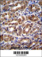 Anti-FABP2 Rabbit Polyclonal Antibody (Biotin)