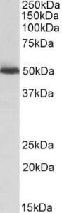 Anti-ALDH2 Goat Polyclonal Antibody