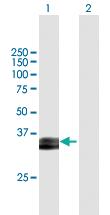 Anti-PRSS8 Mouse Polyclonal Antibody