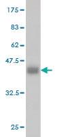 Anti-ADH4 Mouse Monoclonal Antibody [clone: 3C5]