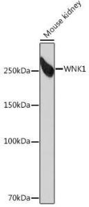 Western blot analysis of extracts of Mouse kidney, using Anti-WNK1 Antibody [ARC0932] (A307765) at 1:1,000 dilution