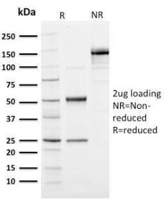 SDS-PAGE analysis of Anti-Ubiquitin Antibody [UBB/1748] under non-reduced and reduced conditions; showing intact IgG and intact heavy and light chains, respectively. SDS-PAGE analysis confirms the integrity and purity of the antibody.