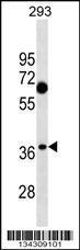 Anti-C1QTNF7 Rabbit Polyclonal Antibody (FITC (Fluorescein Isothiocyanate))