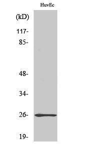 Western blot analysis of COLO205 cells using Anti-RABL2A Antibody