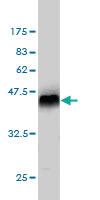 Anti-MAPK13 Mouse Monoclonal Antibody [clone: 2B2]