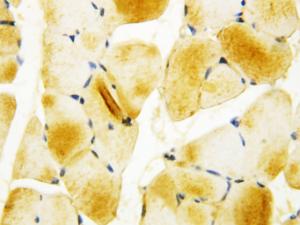 Anti-Carbonic Anhydrase I Rabbit Polyclonal Antibody