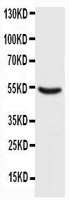 Anti-p53 Mouse Monoclonal Antibody [clone: IMD-53]