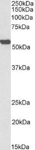 Anti-ALDH2 Antibody (A82978 / Biotin) (0.3µg/ml) staining of Mouse Liver lysate (35µg protein in RIPA buffer), exactly mirroring its parental non-biotinylated product. Primary incubation was 1 hour.