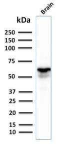 Western blot analysis of human brain tissue lysate using Anti-GAD67 Antibody [GAD1/2391]