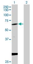 Anti-CPNE1 Rabbit Polyclonal Antibody