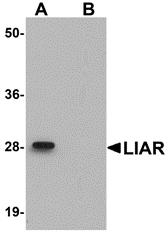 Western blot analysis of LIAR in mouse kidney tissue lysate with LIAR antibody at 1 &#956;g/mL in (A) the absence and (B) the presence of blocking peptide.