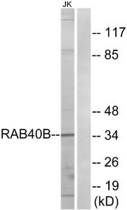 Western blot analysis of lysates from Jurkat cells using Anti-RAB40B Antibody. The right hand lane represents a negative control, where the antibody is blocked by the immunising peptide