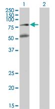 Anti-BBS2 Mouse Polyclonal Antibody