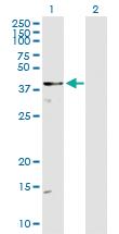 Anti-DOCK2 Rabbit Polyclonal Antibody