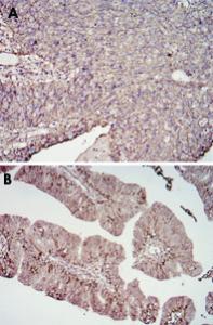 Anti-CD276 Mouse Monoclonal Antibody [clone: 6A1]