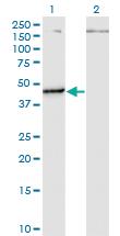 Anti-PUS1 Mouse Monoclonal Antibody [clone: 3A3]