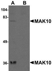 Western blot analysis of MAK10 in rat heart tissue lysate with MAK10 antibody at 1 &#956;g/mL in the (A) absence and (B) presence of blocking peptide.