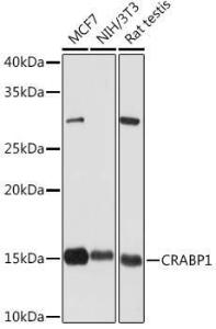 Western blot analysis of extracts of various cell lines, using Anti-CRABP1 Antibody [ARC1991] (A308999) at 1:1,000 dilution The secondary antibody was Goat Anti-Rabbit IgG H&L Antibody (HRP) at 1:10,000 dilution Lysates/proteins were present at 25 µg per lane