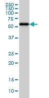 Anti-CPNE1 Mouse Monoclonal Antibody [clone: 8B8]