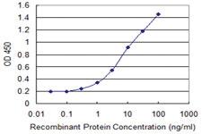 Anti-DEPDC7 Mouse Monoclonal Antibody [clone: 4D9]