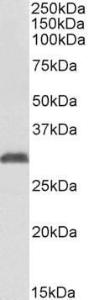 Anti-NAT1 Antibody (A82979) (1 µg/ml) staining of Human Erythrocytes lysate (35 µg protein in RIPA buffer). Primary incubation was 1 hour. Detected by chemilu minescence