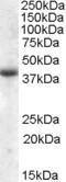 Antibody anti-APOL6 A84593-100 100 µg