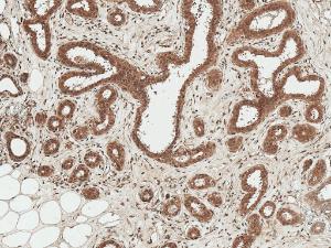 Immunohistochemistry analysis of human breast, fixed in formalin and paraffin-embedded The Primary Antibody used was Anti-Wnt3 Antibody (A304929) at 1:50 for 30 minutes at room temperature Counterstain: Hematoxylin Magnification: 10X HRP-DAB Detection