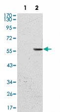 Anti-CD276 Mouse Monoclonal Antibody [clone: 6A1]